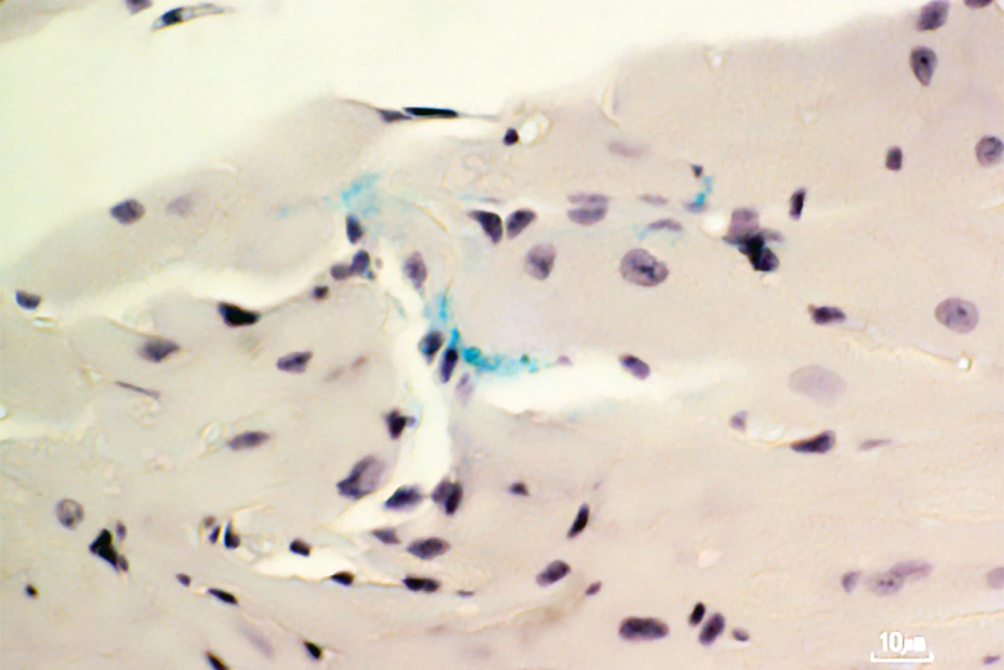 P. gingivalis bacteria (blue-green) enter the heart muscle through small blood vessels in the left atrium