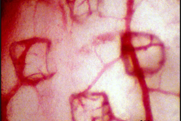 The growth of these blood vessels was caused and directed by the microvascular stamp