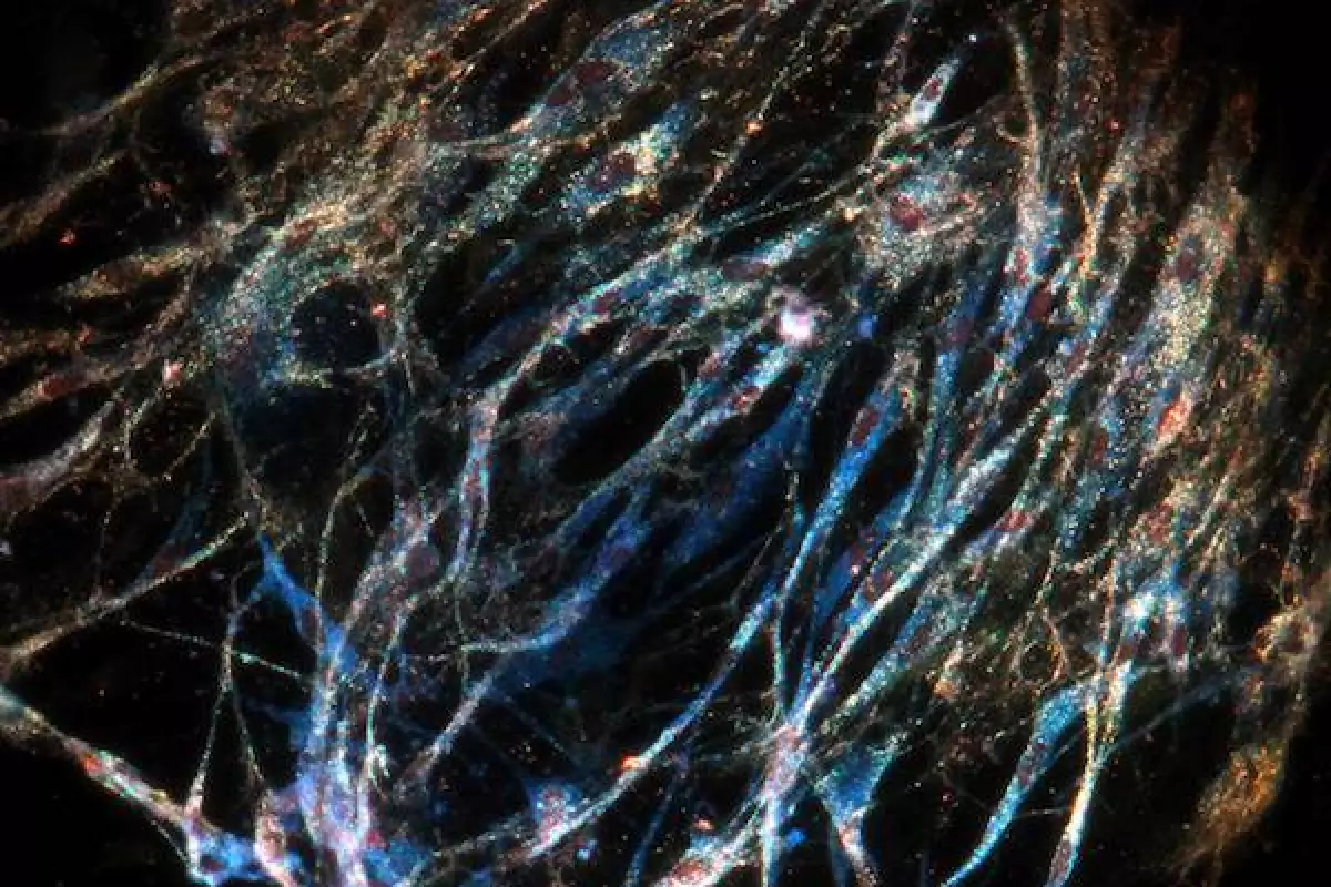 Nanoshells, shown here as tiny points of light, that accumulate in tumor vessels can be coated with drug-infused hydrogels to deliver a knockout punch