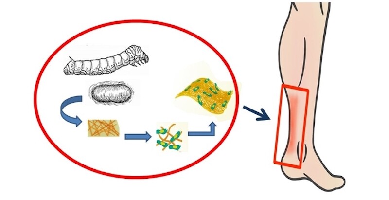 The new scaffold is made of silk fibroin and a hydrogel, loaded with mesenchymal stem cells