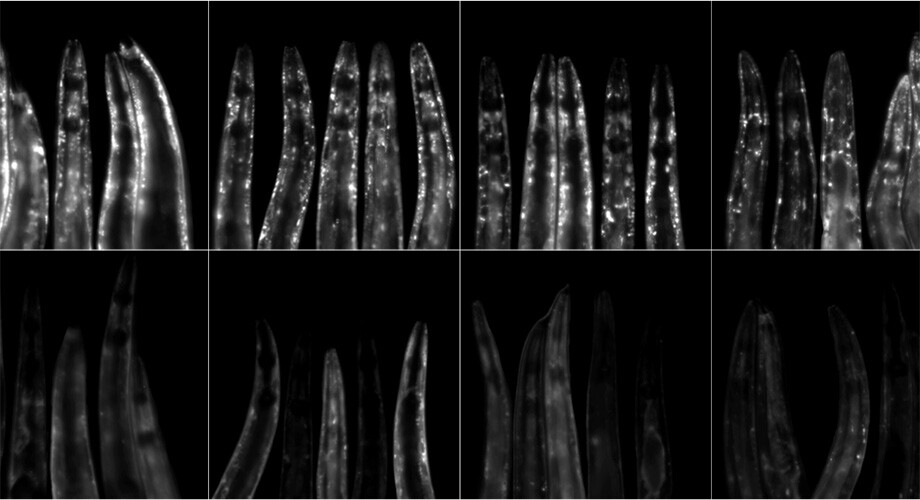 The white spots in these worms are neurodegenerative proteins – the worms on the bottom row, which were given the antibiotic minocycline, have far fewer of these proteins than the control group (top)