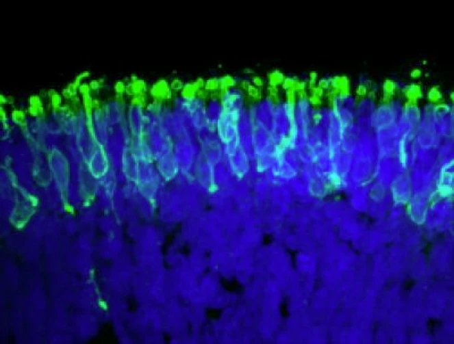 Rod photoreceptors (in green) within a "mini retina" derived from human iPS cells in the lab (Photo: Johns Hopkins)