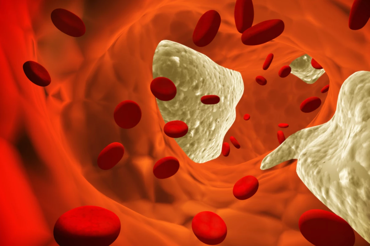 Scientists have developed a set of a molecules that cut down on cholesterol and arterial plaque by shifting the balance of bacterial species in the gut