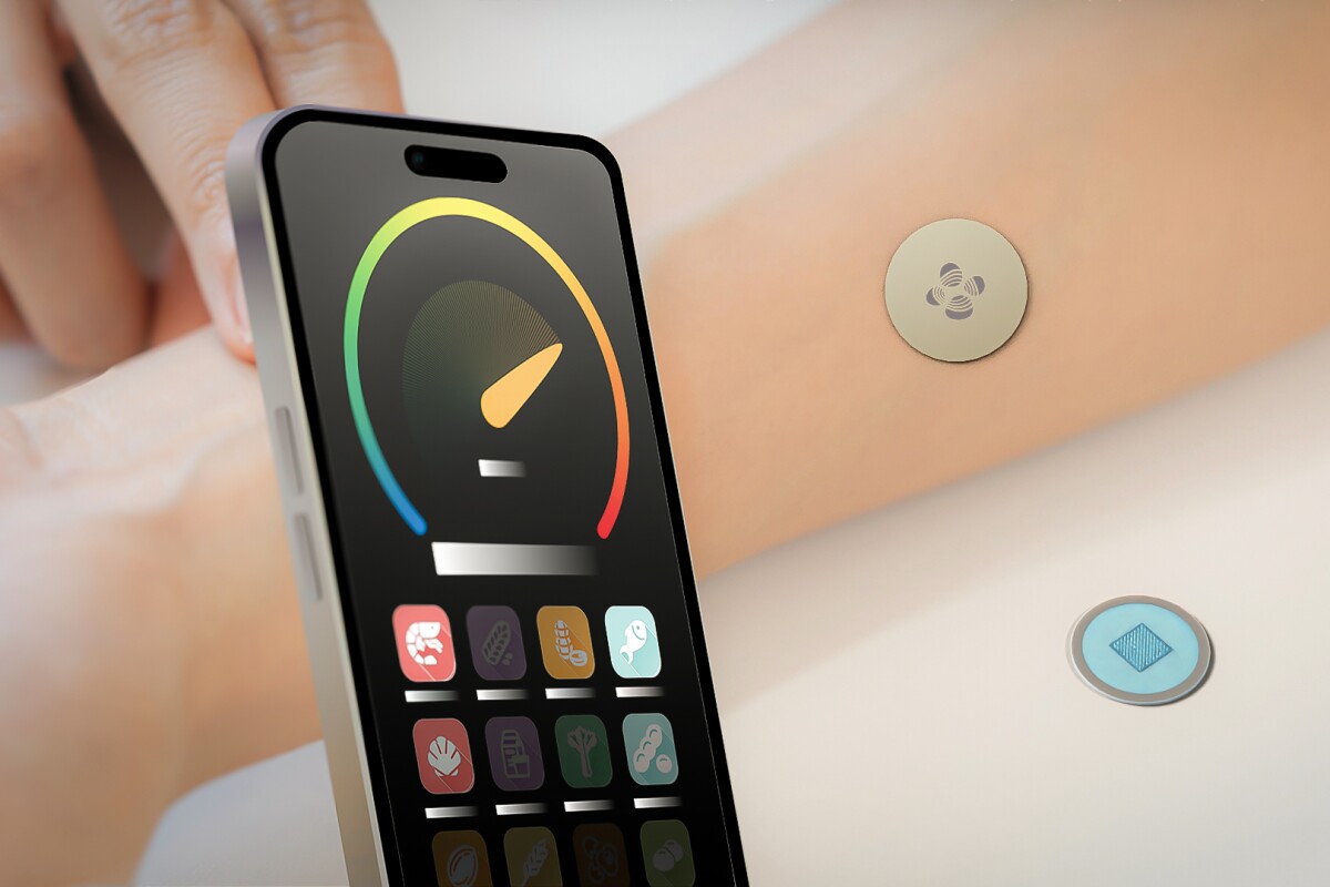 Anaphylaxis alarm system warns of impending danger