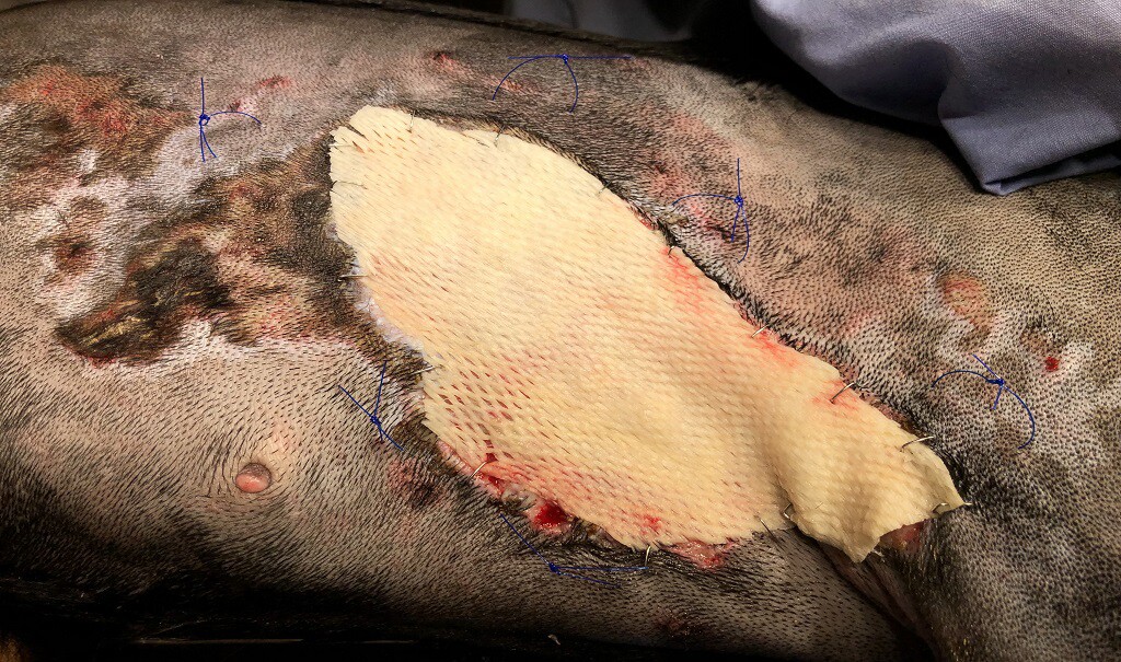 Stella had second and third degree burns covering 10 percent of her body