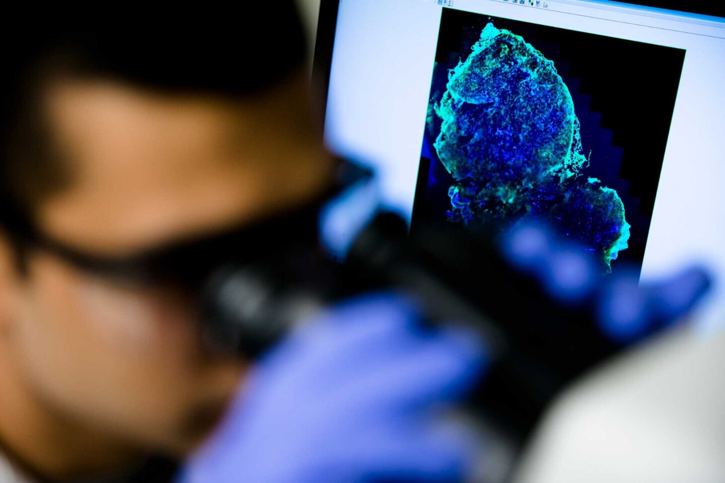 The new technique would allow doctors to pinpoint tumors in breast tissue easily and non-invasively
