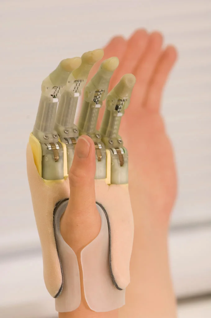 The Touch Bionics ProDigits bionic finger