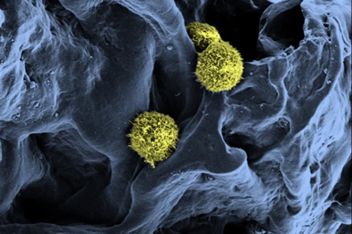 Scanning electron microscopy of stem cells (yellow / green) in a scaffold structure (blue) serving as a basis for the artificial bone marrow (Photo: C. Lee-Thedieck/KIT)
