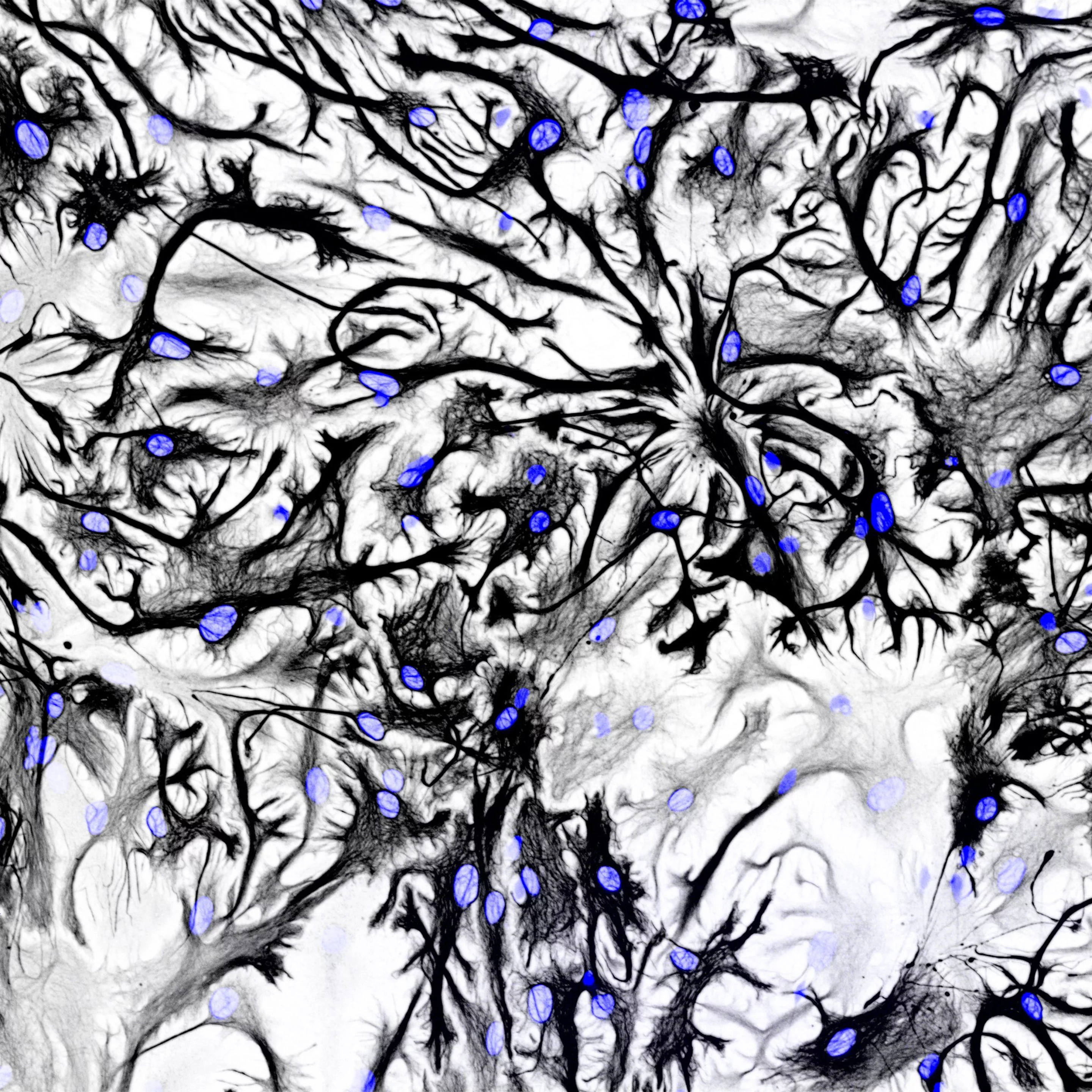 Honorable Mention. Rat astrocytes