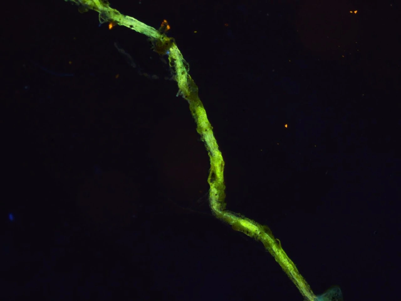 A close-up of a single filament with bacteria cells on its body
