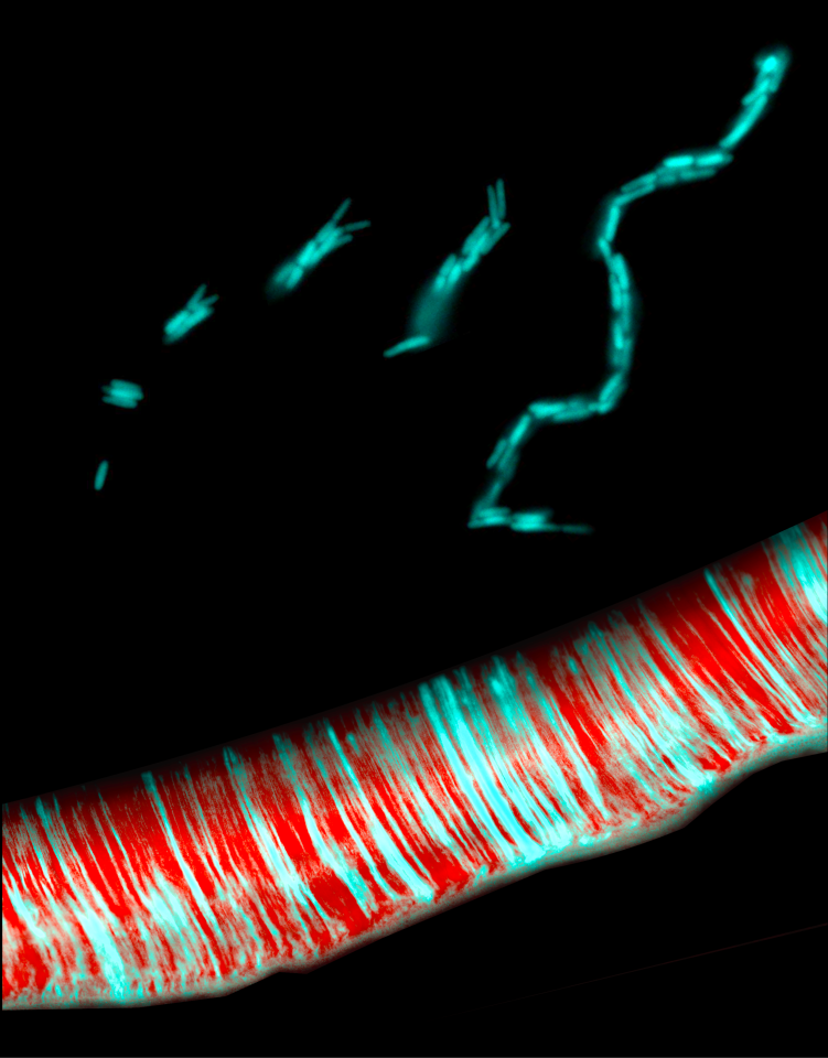 Escherichia coli under the microscope.Showing rosettes forming chains (top) and parallel chains forming biofilms (bottom)
