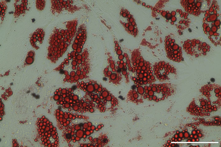 Human brown fat cells can be seen in red