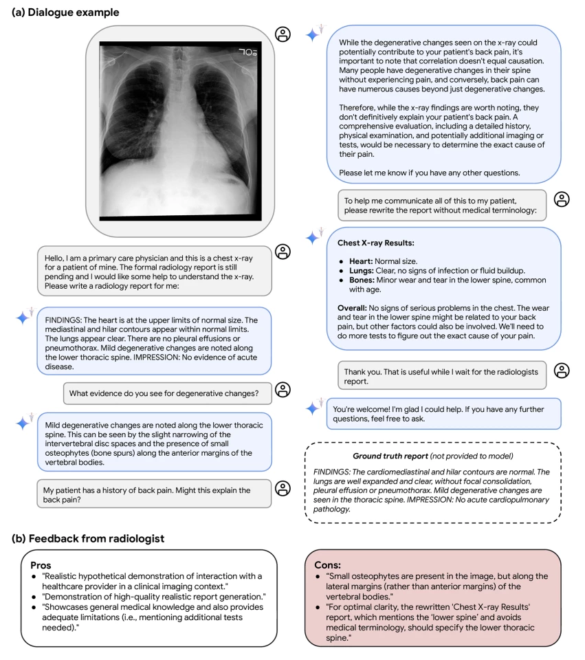 Med-Gemini's diagnostic dialogue assistance in a radiological setting