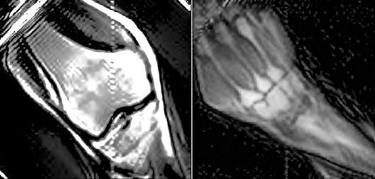 MRI images of knee and wrist joints taken using the TRASE RF phase gradient method (Photo: University of Saskatchewan)