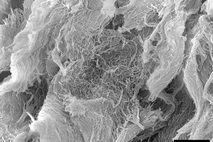 A scanning electron microscope image of the injectable cancer-fighting hydrogel, dubbed STINGel