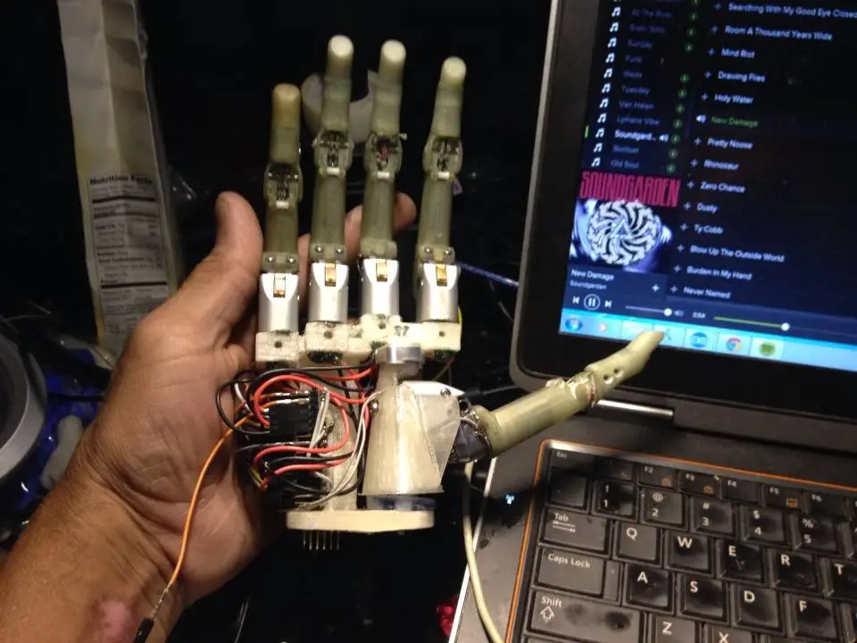 Connor still has to create an artificial skin covering, and hopes to ultimately make the entire hand commercially available as a $4,000 kit