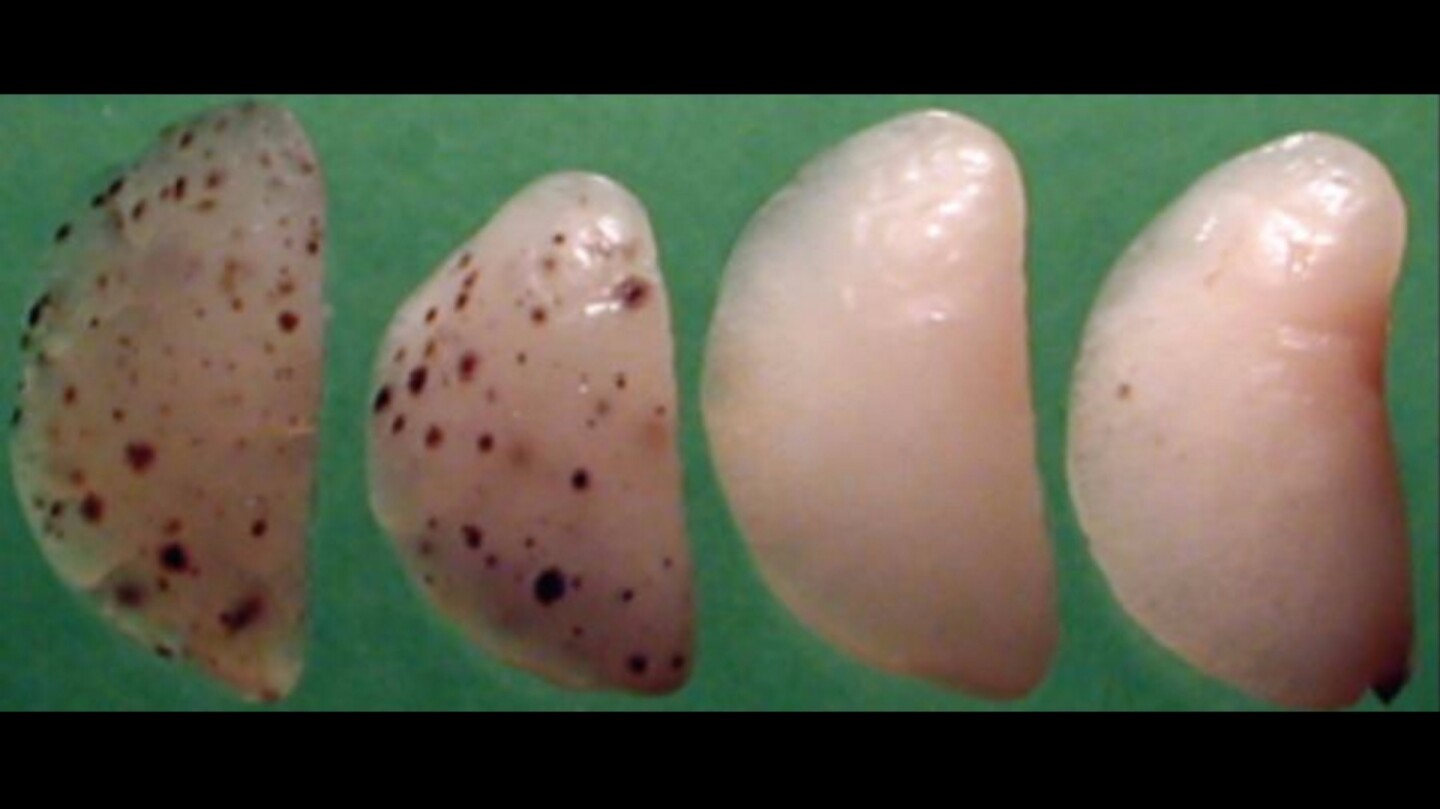 Taking control of key protein helps mice fend off cancer