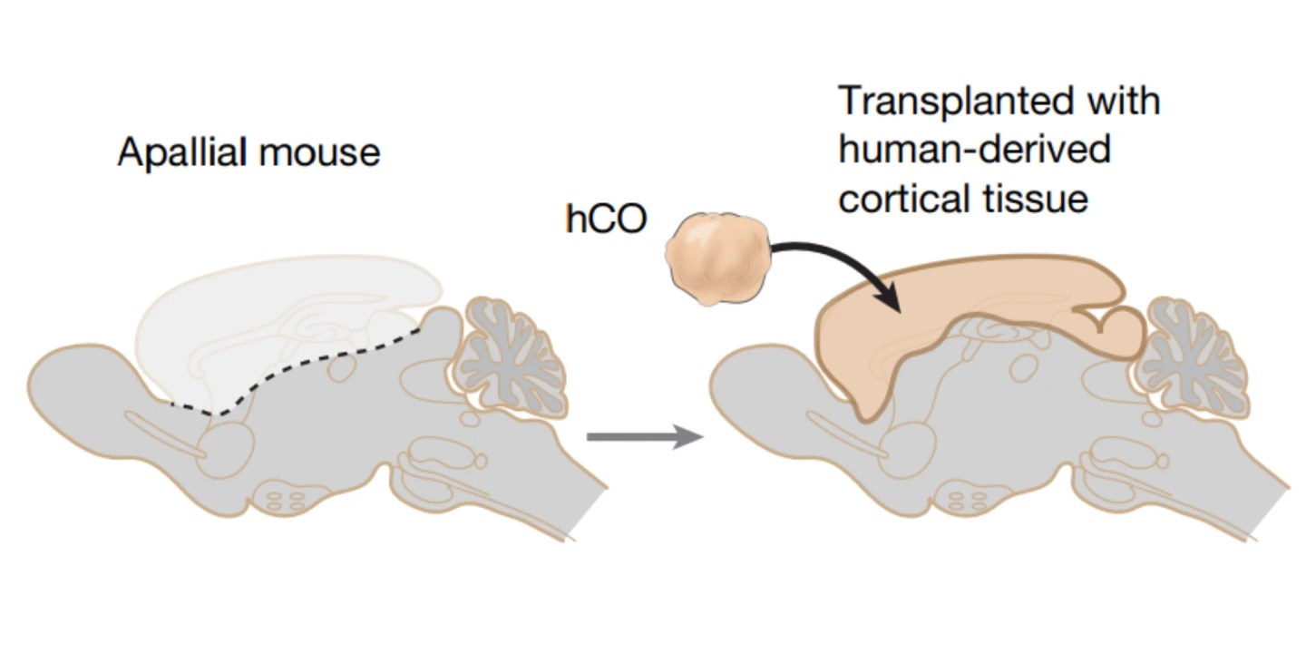 Diagram of xenotransplant