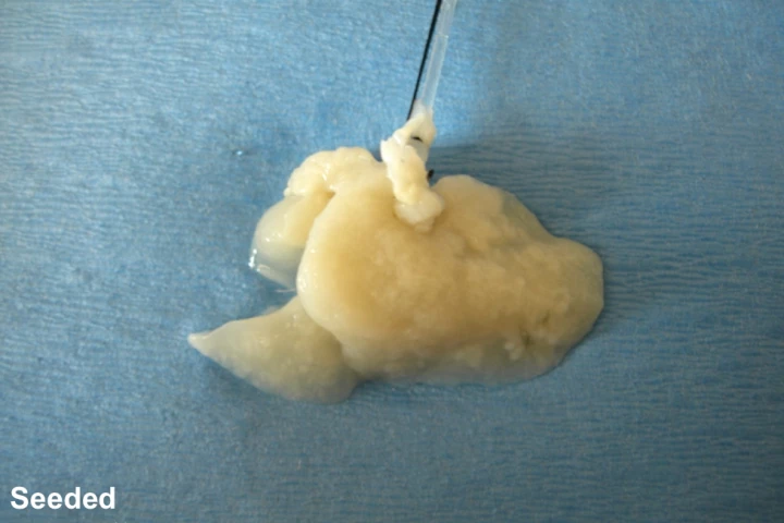 A decellularized liver