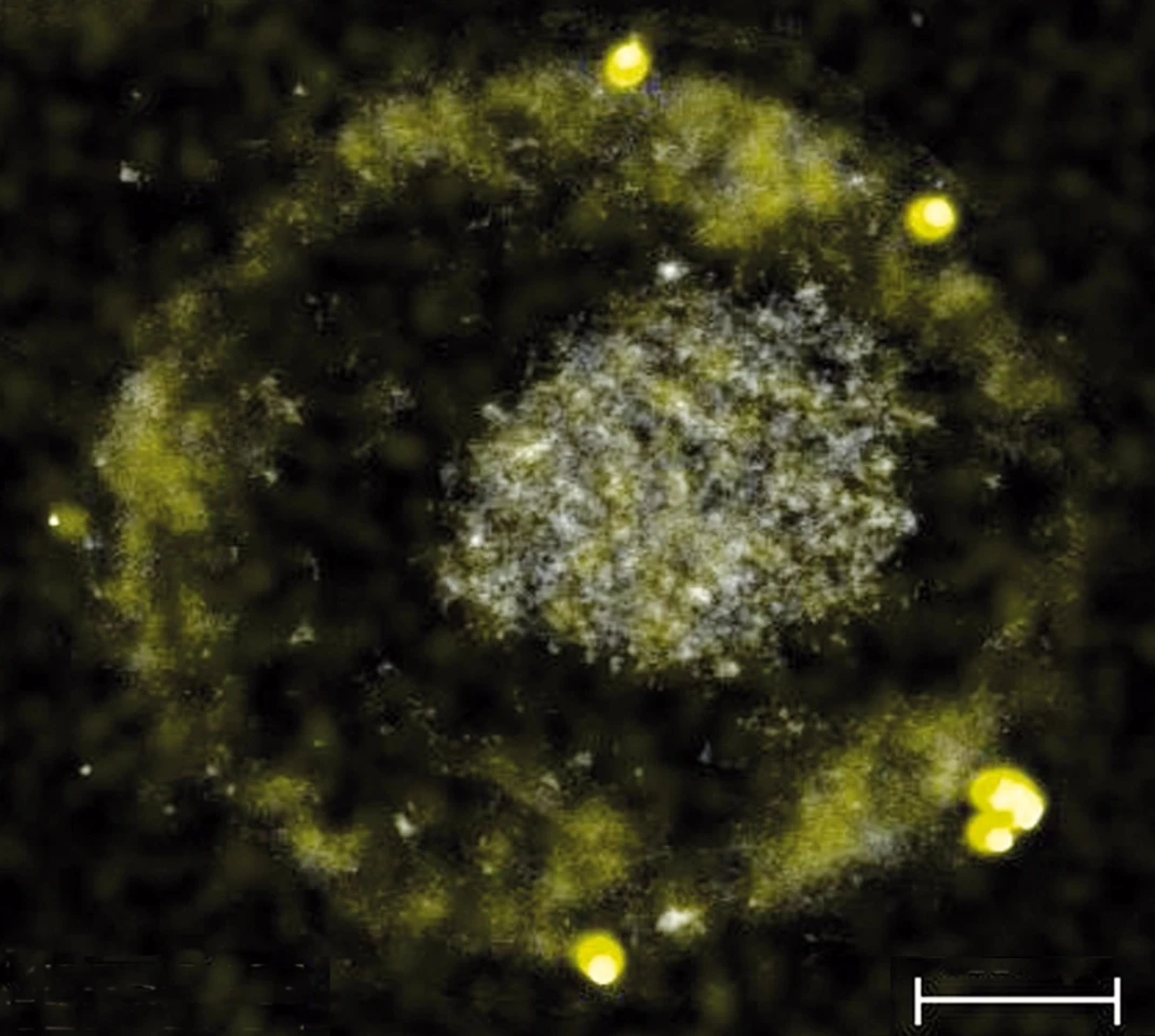 The C. metallidurans bacteria, along with some of the tiny gold nuggets it excretes