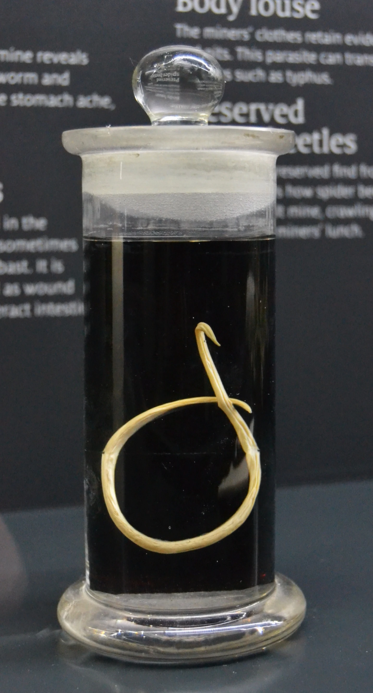 Scientists have mapped the genetic code of the T.canis roundworm (Photo: University of Melbourne)
