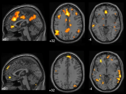 fMRI brain scans from UBC Mind Wandering Study(Image: Courtesy of Kalina Christoff)