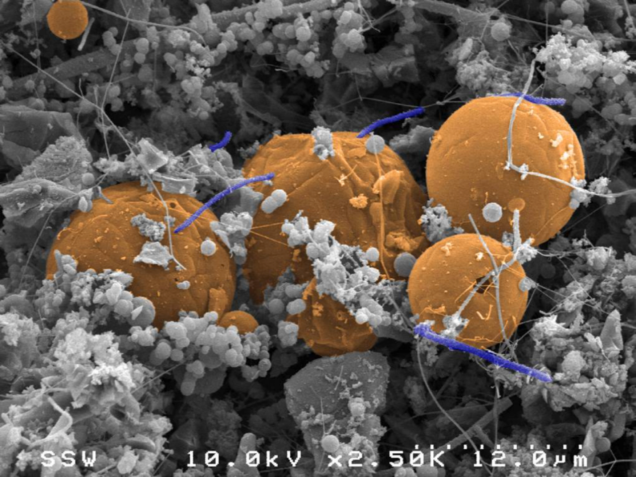 A strange new species known as Candidatus Desulforudis audaxviator, the rods highlighted in blue, as they cling to carbon lumps (orange)