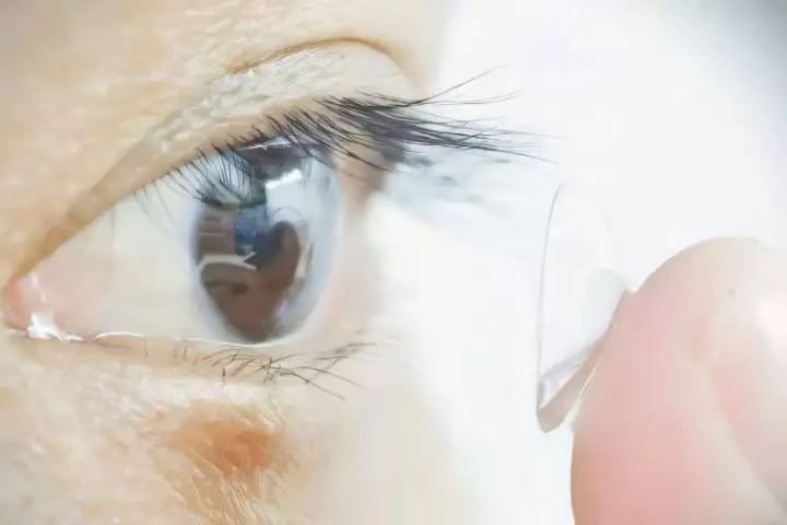 A study participant puts in the clear contact lens impregnated with gold nanoparticles