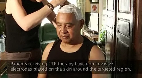 NovoTTF is first ever FDA approved cancer treatment for patients as an alternative to chemotherapy