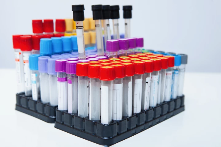 A new test can measure circulating prostate tumor cells in a patient's blood, offering significant improvements on current diagnostic methods