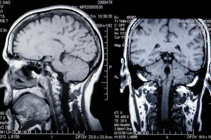 When it comes to determining our biological age, size matters
