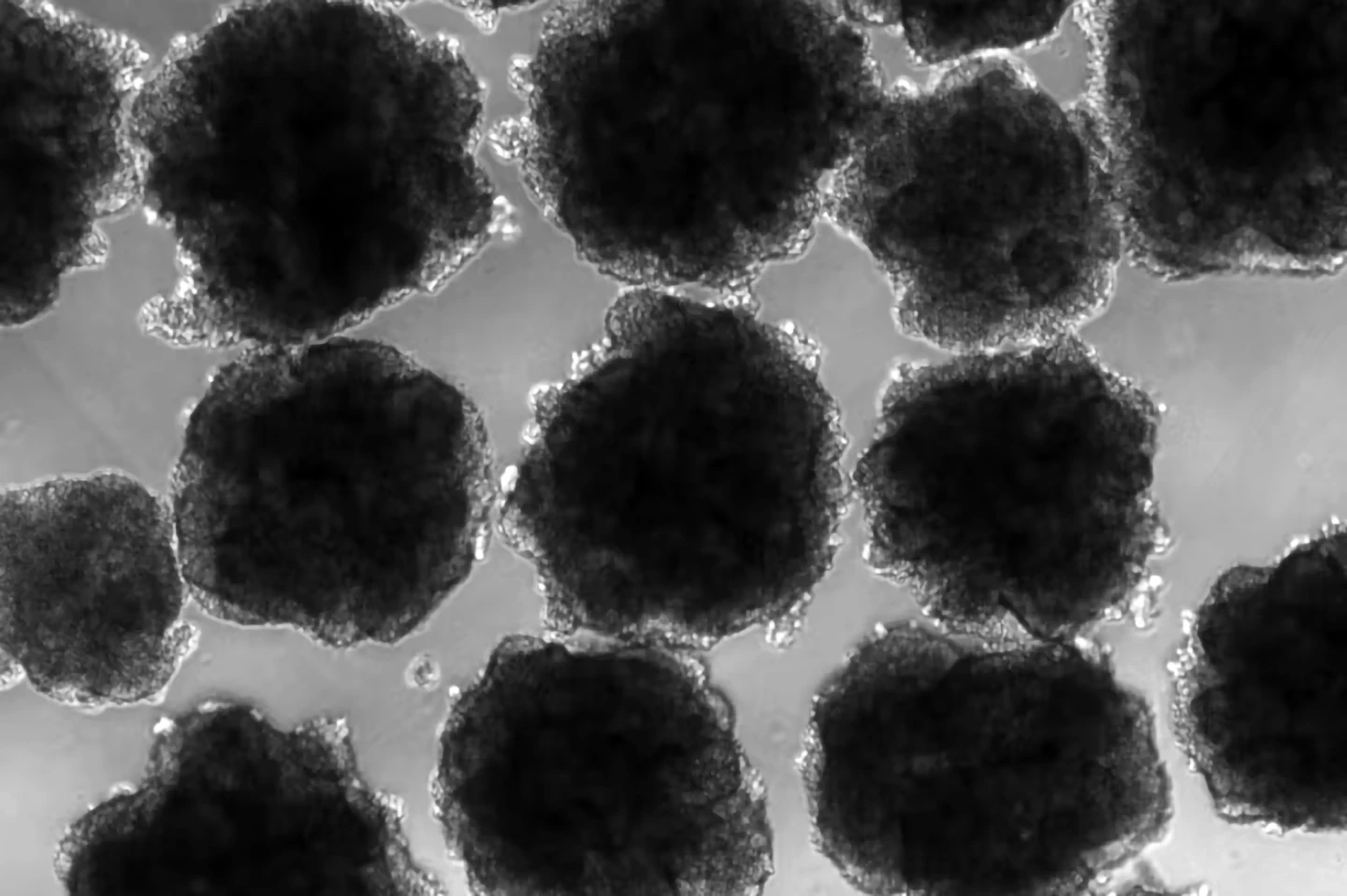 The Neanderthal-like organoids used to test lead exposure