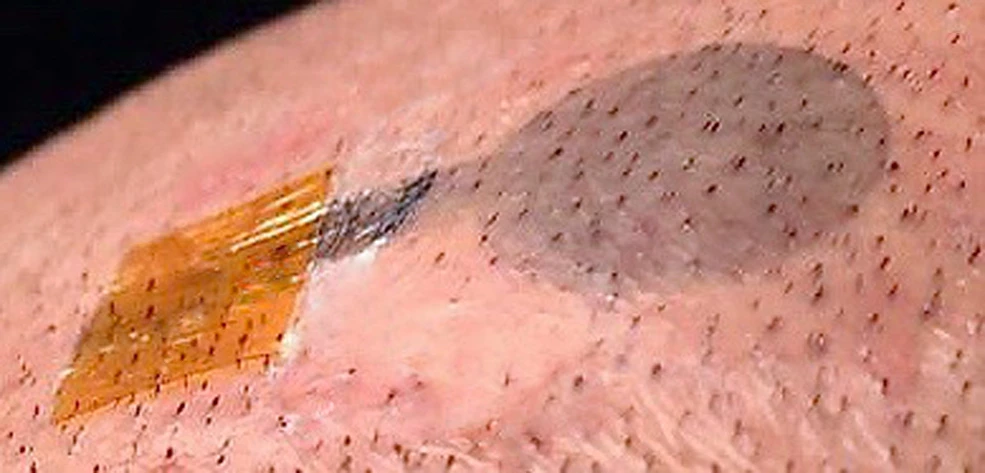 Early tests show the electrodes continue to work effectively even as hair regrows through the temporary tattoo