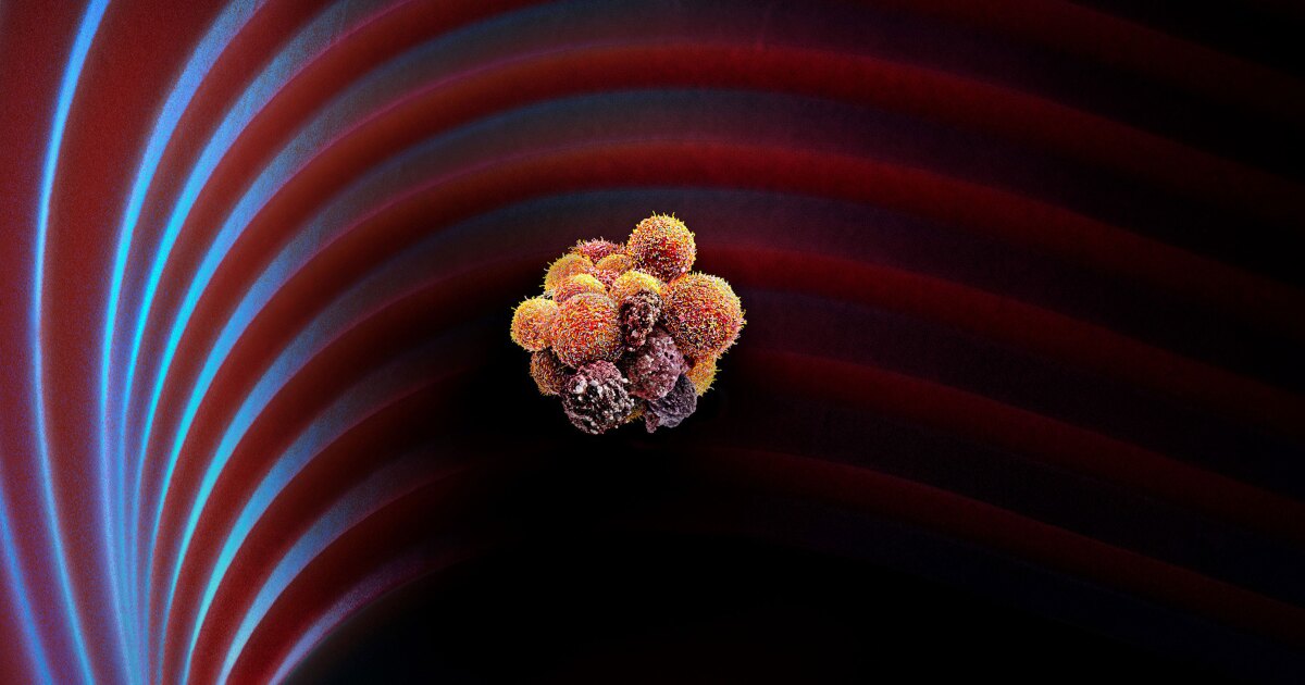 Bestehendes Herzmedikament hilft, die Ausbreitung von Krebs zu verhindern