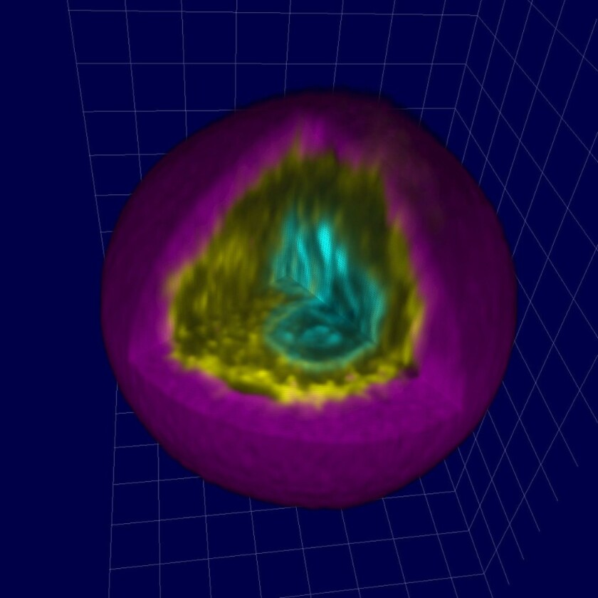 A 3D render of a mesenchymal stromal cell (MSC), including the nucleus (green), cytoskeleton (yellow) and microgel coating (purple)