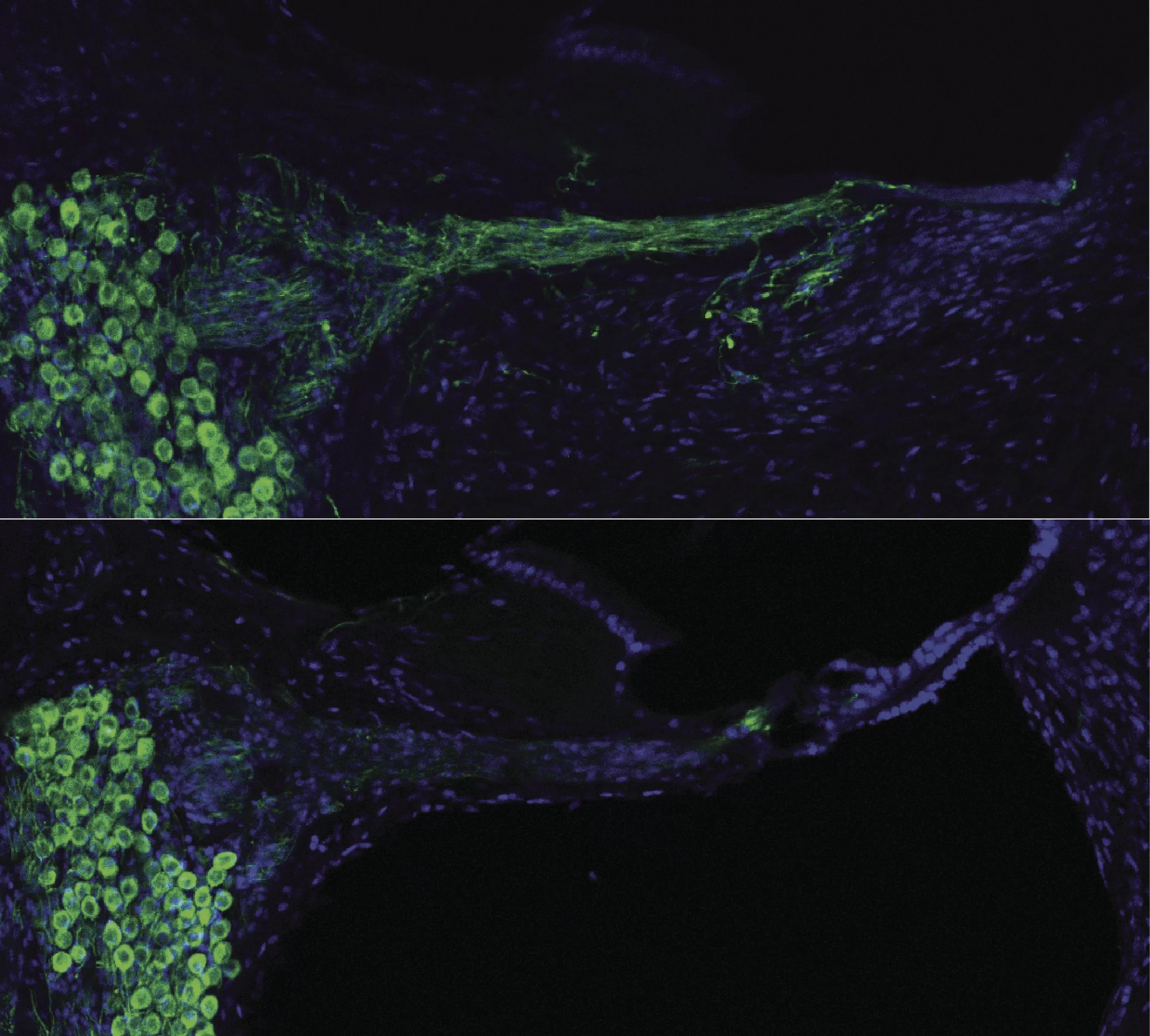 Regenerated auditory nerves using gene therapy (top), control (bottom). (Image: UNSW)
