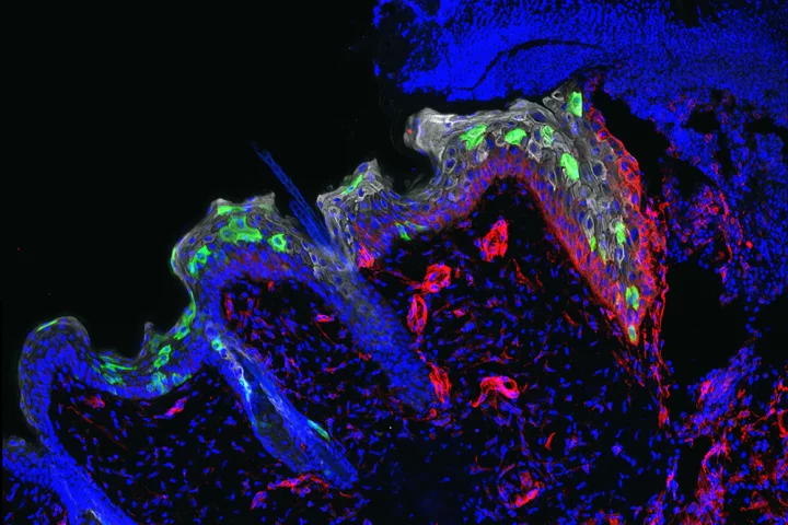 The stem cells (green) move into, and help heal, a wound faster when it has previously suffered a bout of inflammation
