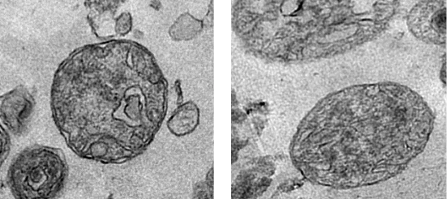 Microscope images of the structures containing fully-functioning mitochondria, which were discovered in the bloodstream for the first time