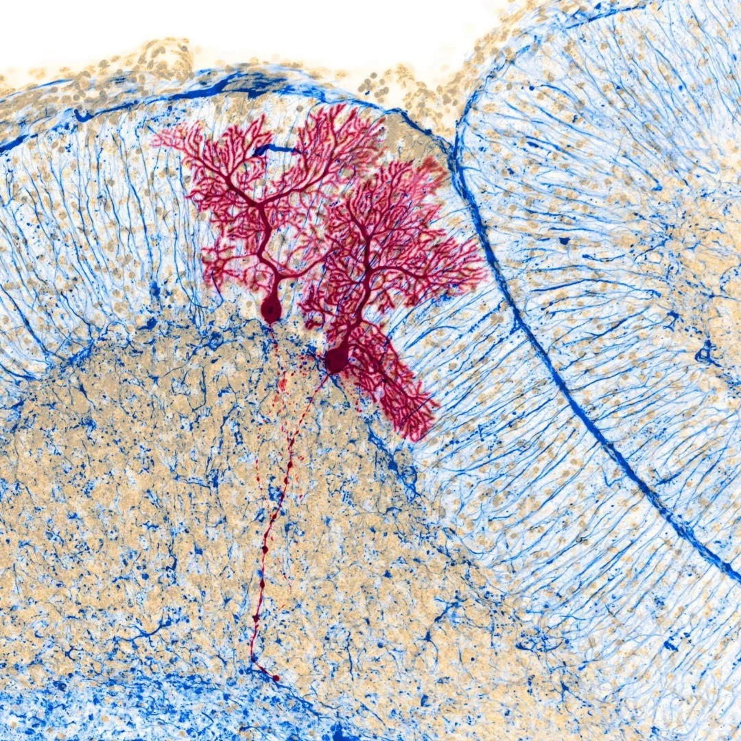 Image of Distinction: Dye-injected Purkinje cells in mouse cerebellum