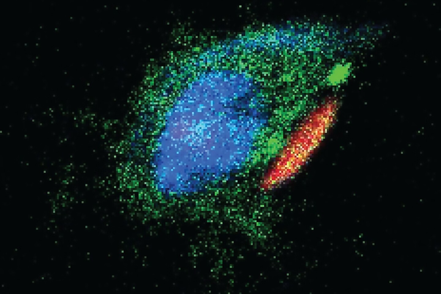 Поражение черепного. Поражение черепного