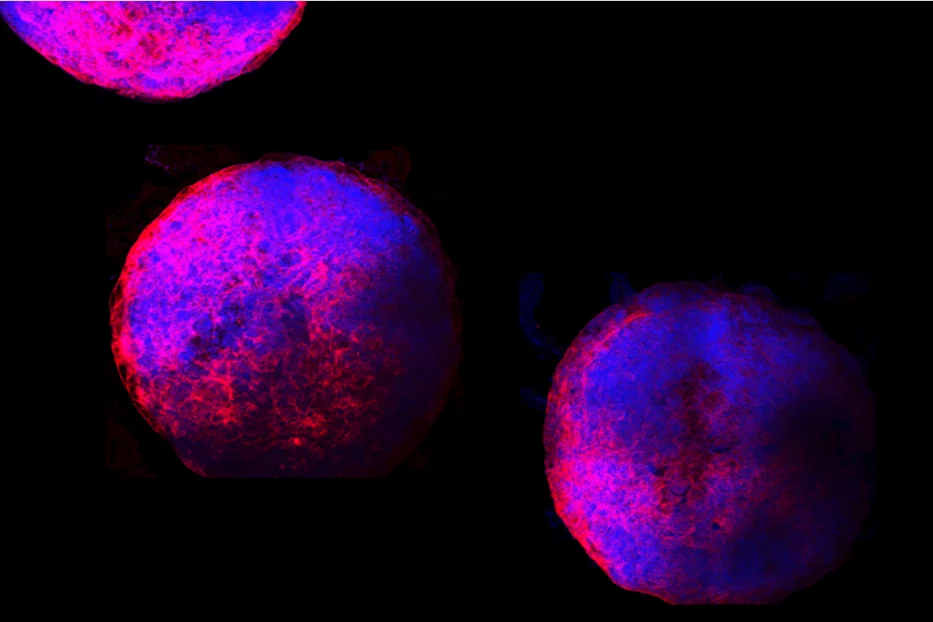 Researchers have grown new mini human hearts from stem cells in the lab