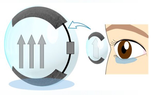 A diagram of the self-moisturizing contact lens