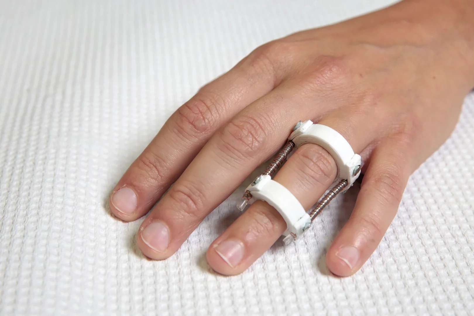 The wire could one day be knitted into electronic casts for broken bones and other medical devices