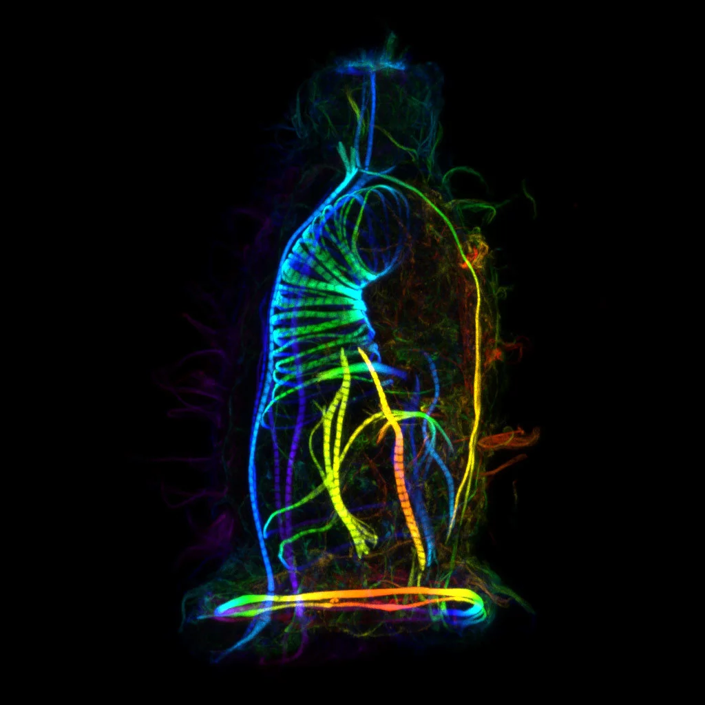 Image of Distinction: Muscles of a Cyphonautes (aquatic invertebrate animal larva)