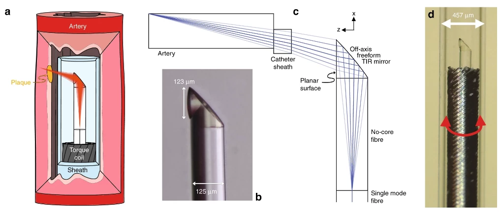 a.) Schematic of the 3D-printed OCT endoscope inside an artery. b.) Microscope image of the 3D-printed off-axis freeform total internal reflection (TIR) mirror on the tip of the no-core fiber that is fusion spliced onto the light-guiding single-mode fiber. c.) Optical design of the system with light exiting the single-mode fiber, expanding in the no-core fiber, being reflected and phase-shaped at the freeform mirror, passing the catheter sheath and focusing into the artery tissue. d.) Photo of the 3D-printed OCT endoscope, which rotates and is pulled back to accomplish full 3D OCT scanning