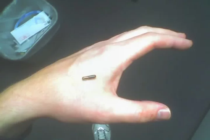 A UK researcher has infected his RFID implant with a computer virus as proof of principle that future devices could be prone to attack (Image: CC)