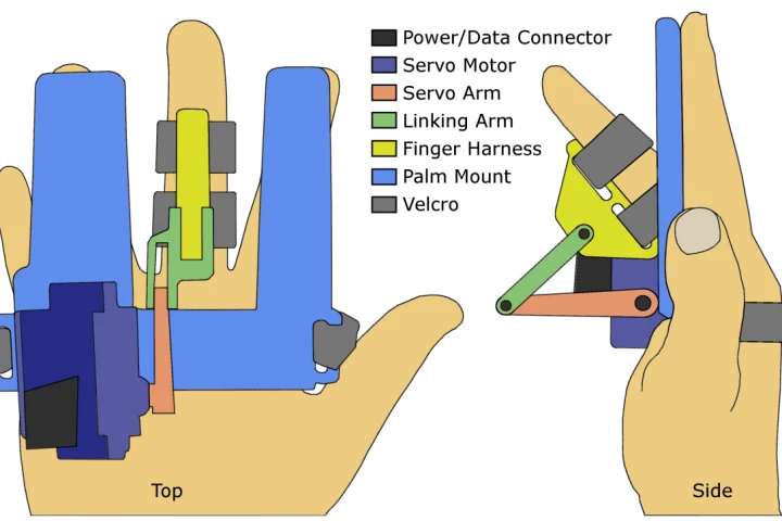 A diagram of the BiRD, which could provide simpler and earlier Parkinson's diagnoses