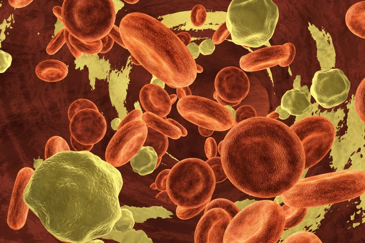 A new gene-silencing drug gives hope of a future where keeping LDL cholesterol levels low is as simple as a small injection from your GP once or twice a year