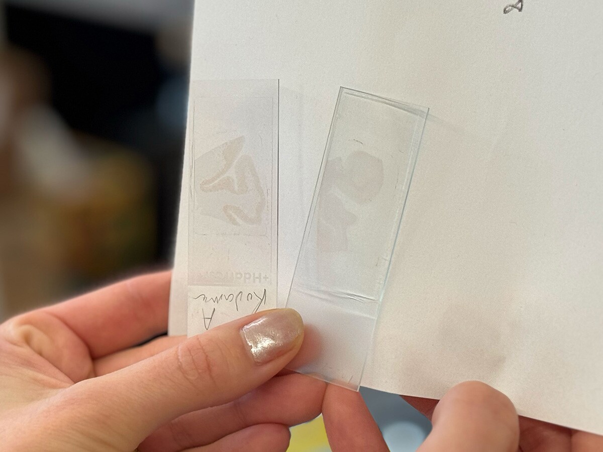 Look closely and you'll see brown amyloid beta plaques are visible in the brain tissue sample in the left slide - on the right is brain tissue that had been treated and no longer contains amyloid plaques