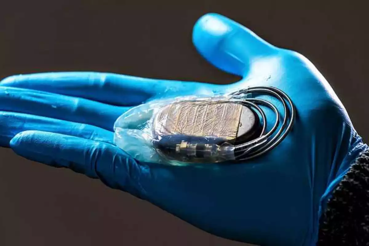 The device is being marketed as the Hylomate Pouch